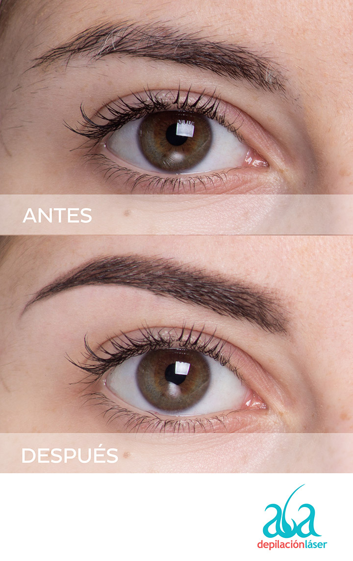 cejas