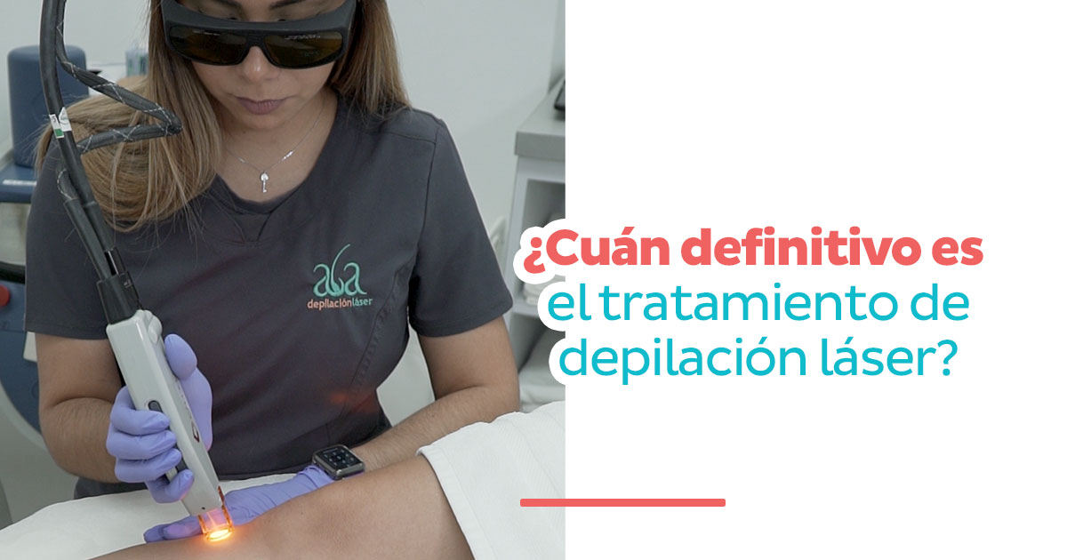 ¿Cuán definitivo es el tratamiento de Depilación Laser?